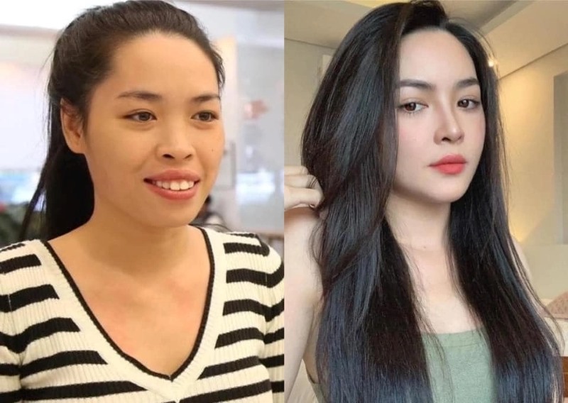 bệnh viện thẩm mỹ hàn quốc